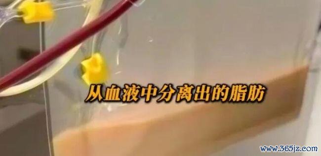 女子每天3杯奶茶 血液变乳白险丧命 奶茶青睐者需警惕